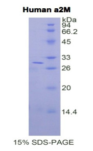 Human Recombinant Alpha-2-Macroglobulin (a2M)